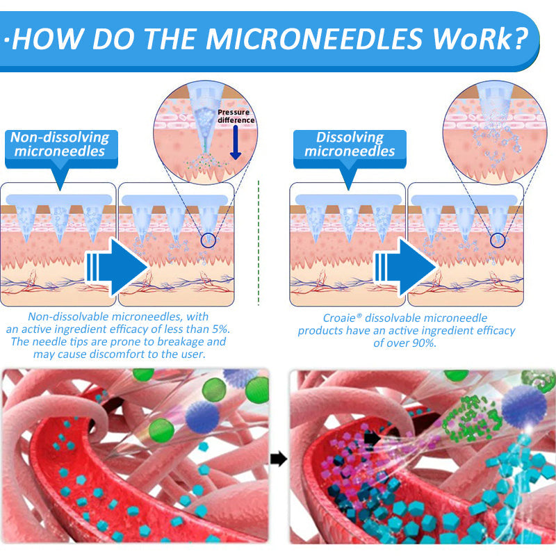 CROAIE Nano Microneedle Patch with SMGT-GLP-1 & Matrixyl 3000 โ Slimming, Skin Tightening, Blood Sugar Support, No Injection, 7-Day Result